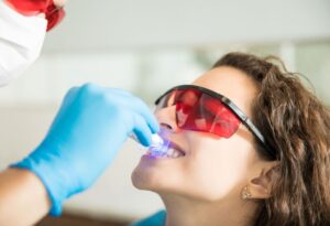 Beneficios del blanqueamiento dental profesional
